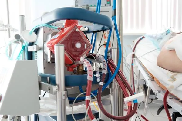 ECMO